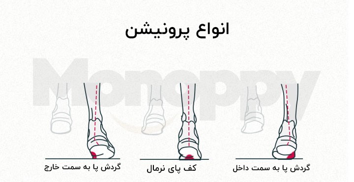 انواع پرونیشن انتخاب کفش مناسب دویدن